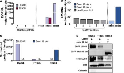 Epidermal Growth Factor Receptor Mutations Carried in Extracellular Vesicle-Derived Cargo Mirror Disease Status in Metastatic Non-small Cell Lung Cancer